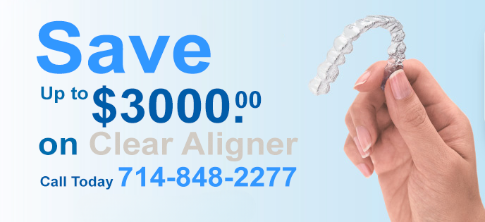 save-on-clear-aligner-copy_cleanup